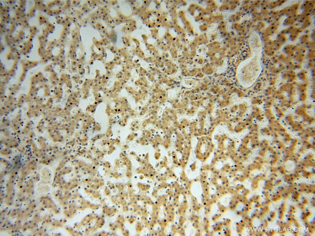 Immunohistochemistry (IHC) staining of human liver tissue using PSG11 Polyclonal antibody (16352-1-AP)