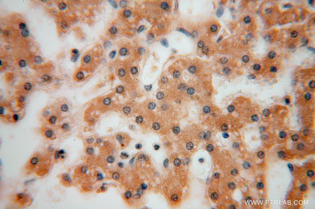 Immunohistochemistry (IHC) staining of human liver tissue using PSG11 Polyclonal antibody (16352-1-AP)
