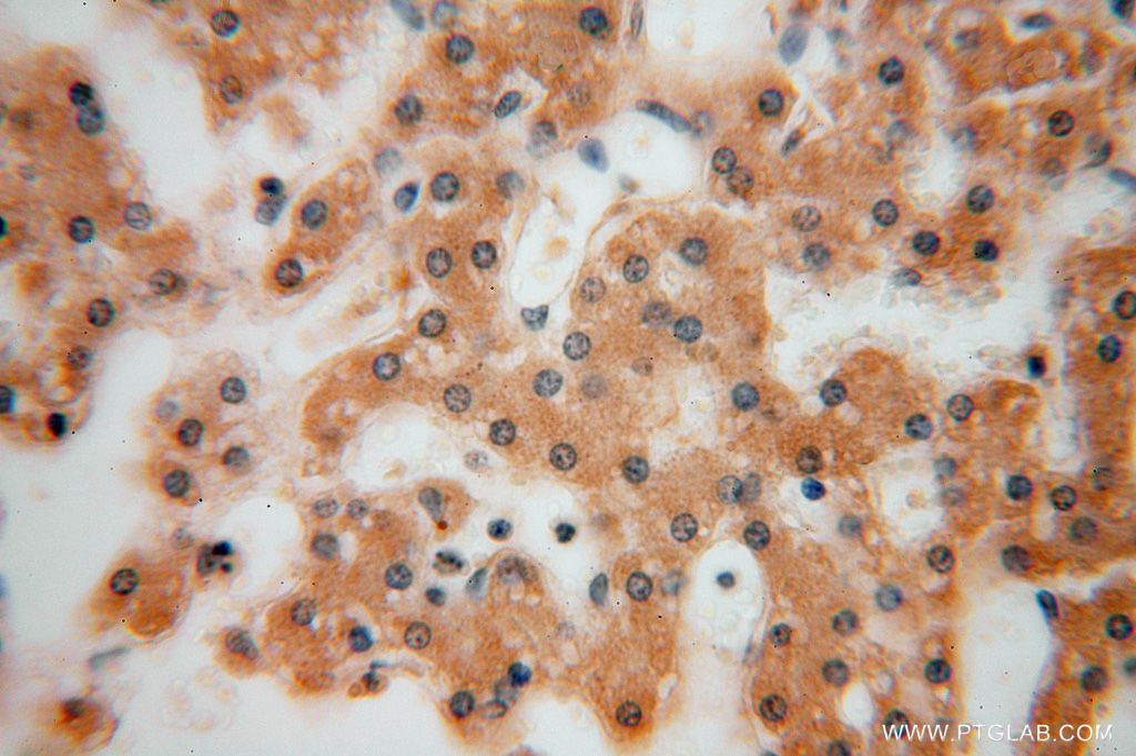 IHC staining of human liver using 16352-1-AP