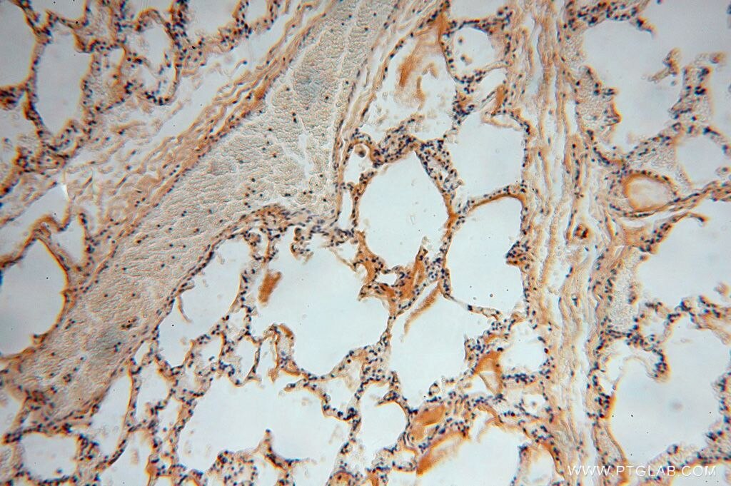 Immunohistochemistry (IHC) staining of human lung tissue using PSG11 Polyclonal antibody (16352-1-AP)
