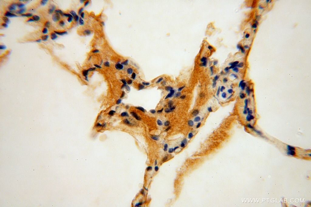 Immunohistochemistry (IHC) staining of human lung tissue using PSG11 Polyclonal antibody (16352-1-AP)