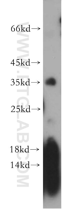 Western Blot (WB) analysis of HeLa cells using PSG11 Polyclonal antibody (16352-1-AP)