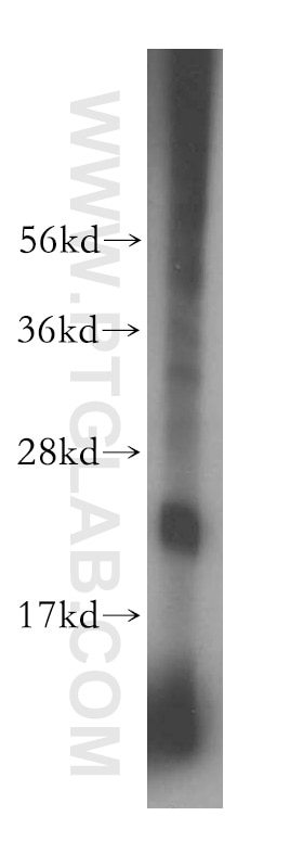 Western Blot (WB) analysis of mouse uterus tissue using PSG11 Polyclonal antibody (16352-1-AP)