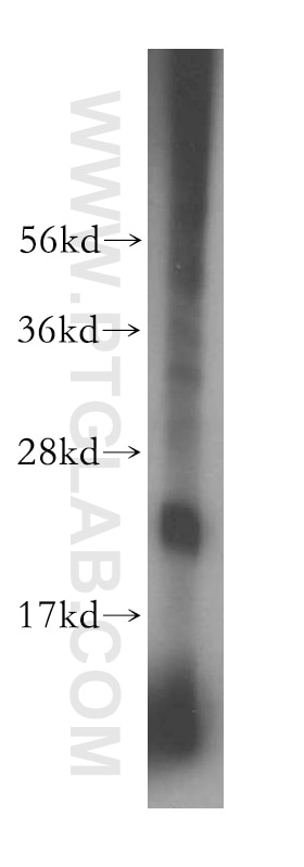 WB analysis of mouse uterus using 16352-1-AP