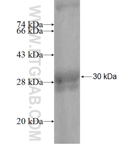PSG11 fusion protein Ag9877 SDS-PAGE PSG11 fusion protein Ag9877 SDS-PAGE