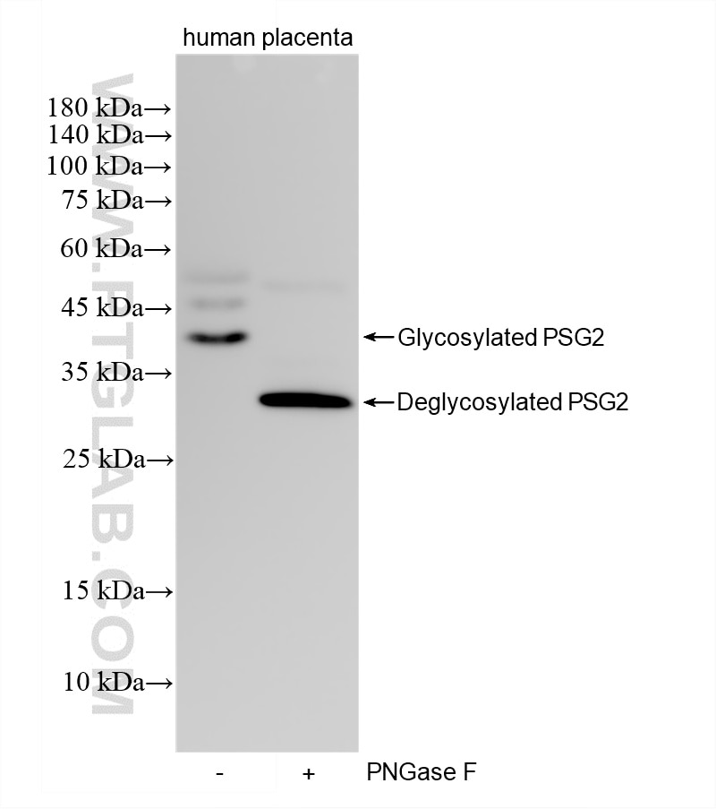 WB analysis using 87951-1-RR (same clone as 87951-1-PBS) Western Blot (WB) analysis of various lysates using PSG2 Recombinant monoclonal antibody (87951-1-RR)