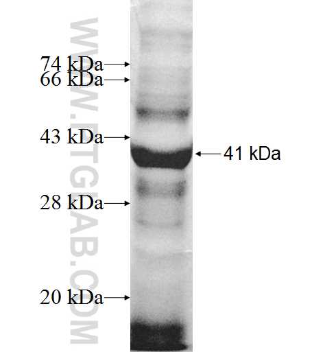 PSG2 fusion protein Ag9799 SDS-PAGE