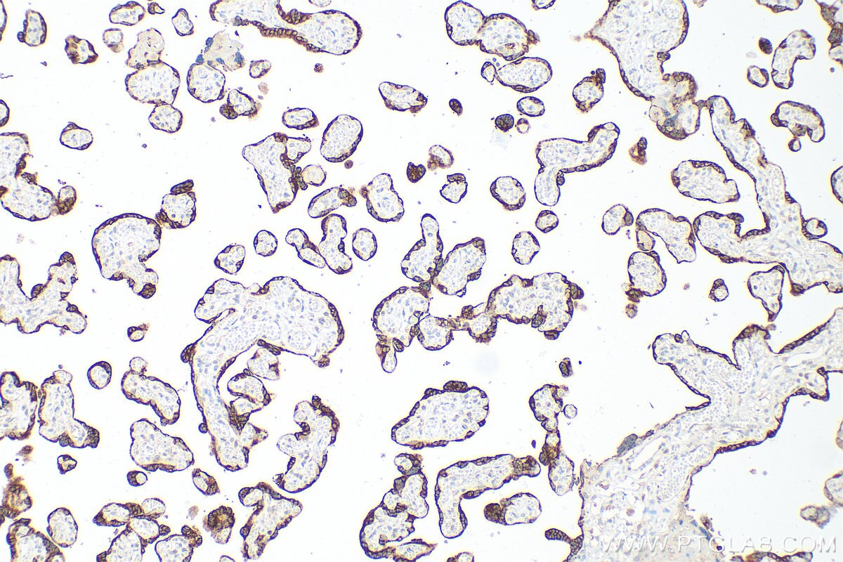 Immunohistochemistry (IHC) staining of human placenta tissue using PSG3 Polyclonal antibody (15375-1-AP)
