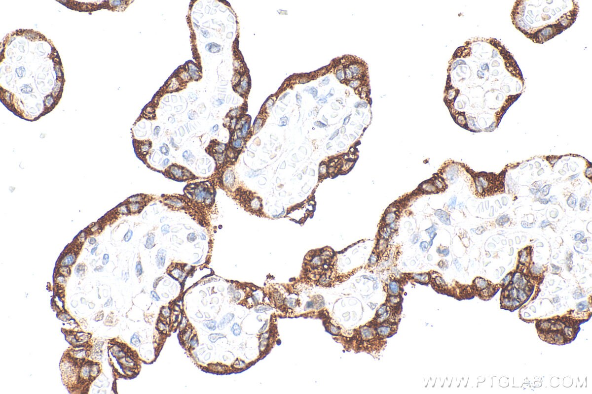 Immunohistochemistry (IHC) staining of human placenta tissue using PSG3 Polyclonal antibody (15375-1-AP)