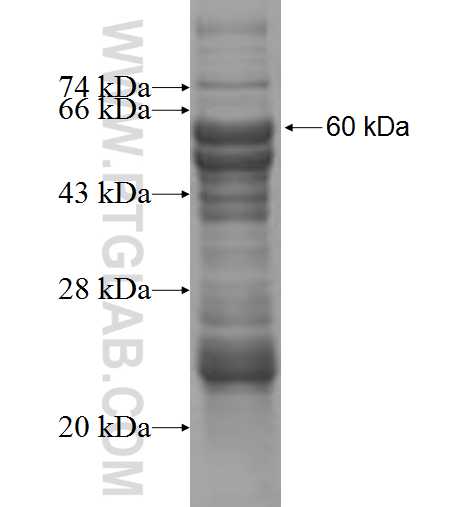 PSG3 fusion protein Ag1148 SDS-PAGE