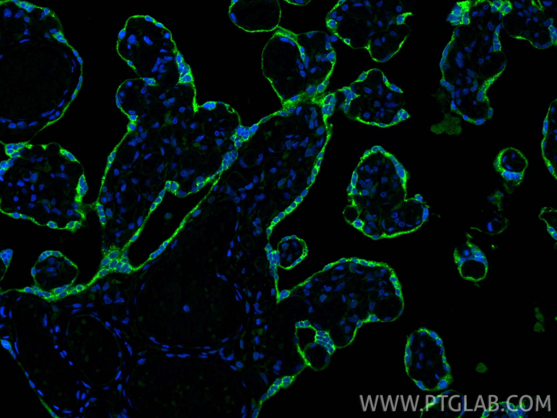 Immunofluorescence (IF) / fluorescent staining of human placenta tissue using PSG4 Polyclonal antibody (10902-2-AP)