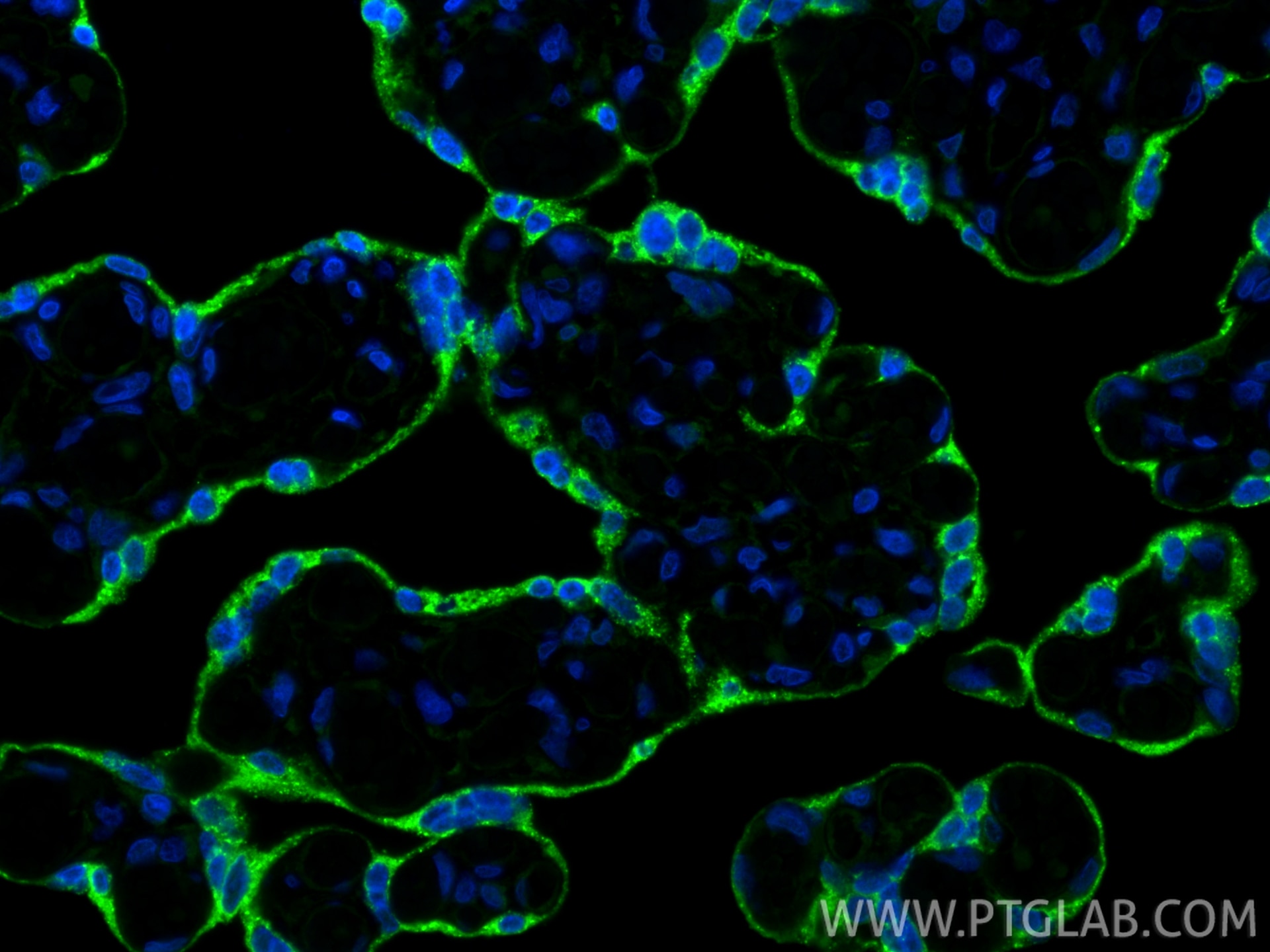Immunofluorescence (IF) / fluorescent staining of human placenta tissue using PSG4 Polyclonal antibody (10902-2-AP)