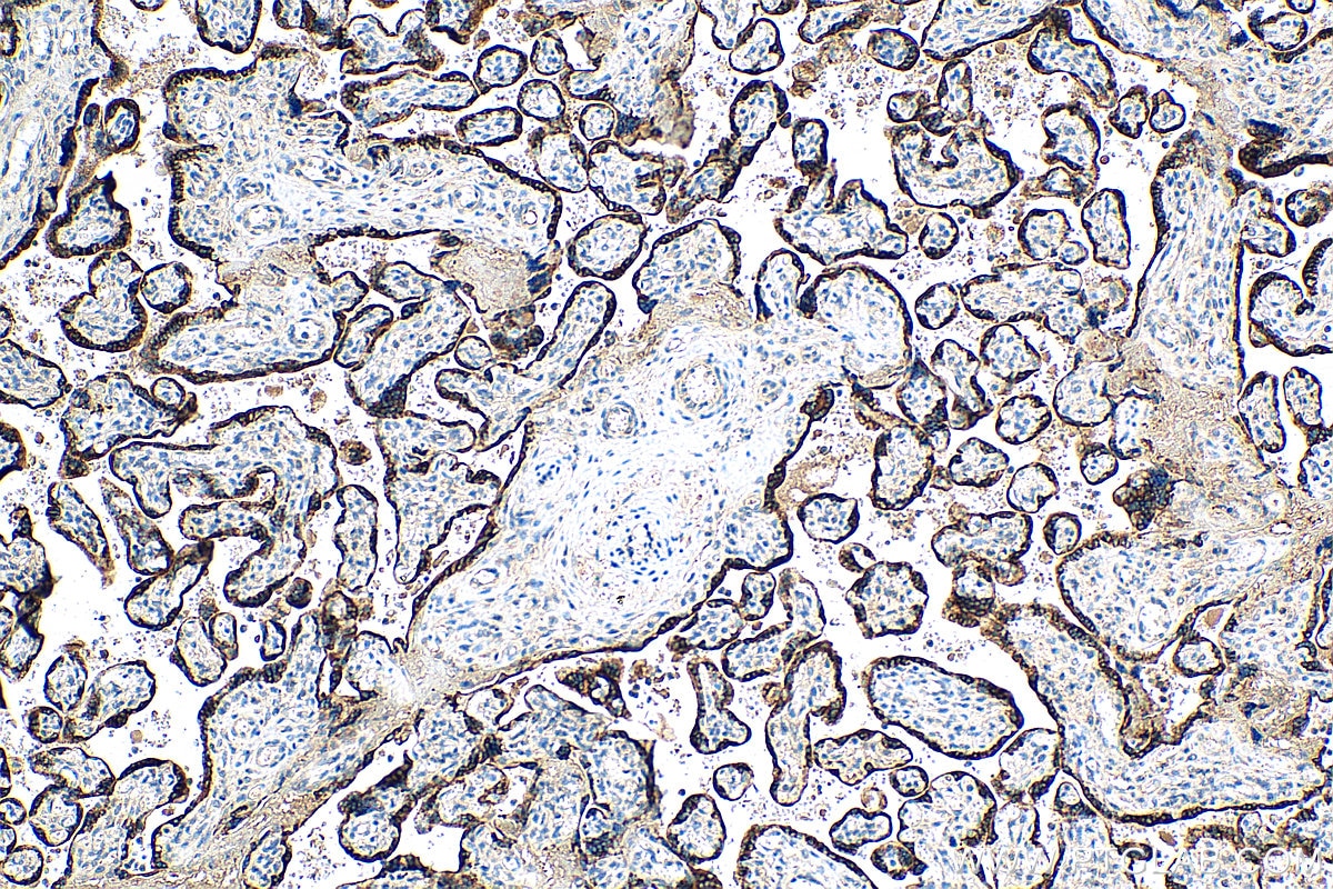 Immunohistochemistry (IHC) staining of human placenta tissue using PSG4 Polyclonal antibody (10902-2-AP)