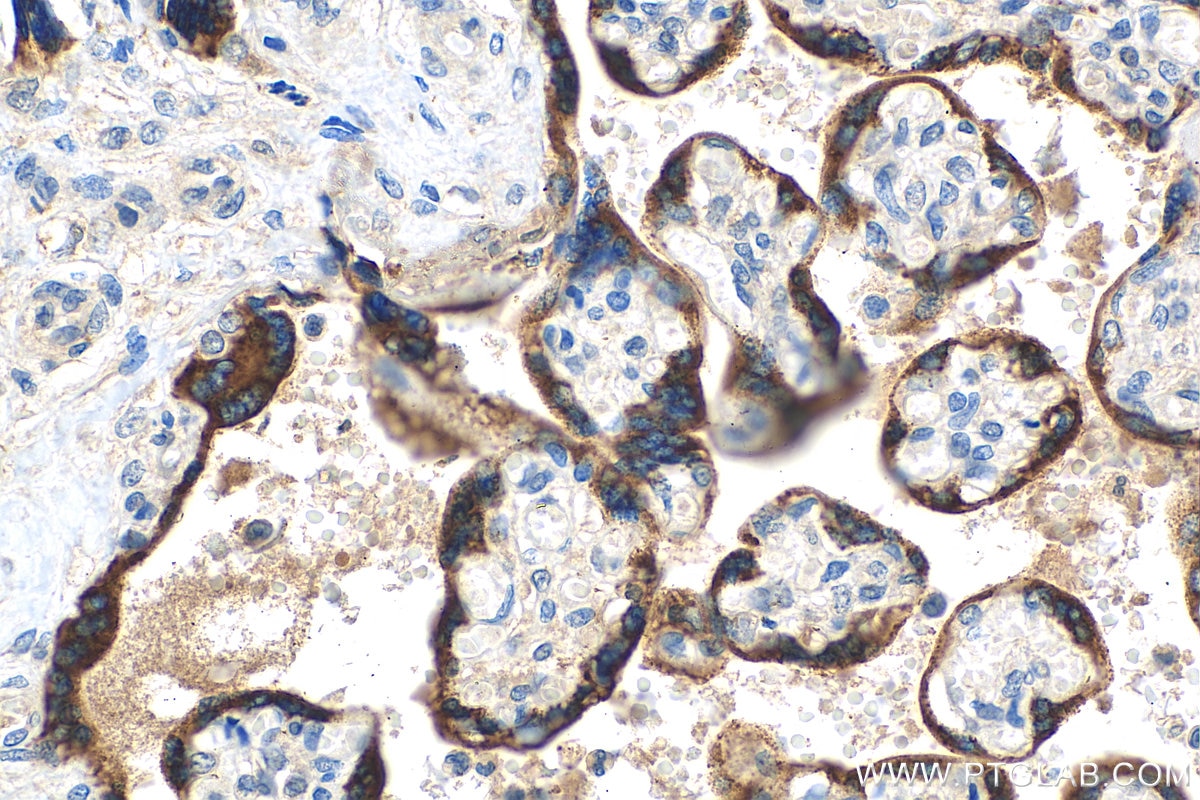 Immunohistochemistry (IHC) staining of human placenta tissue using PSG4 Polyclonal antibody (10902-2-AP)