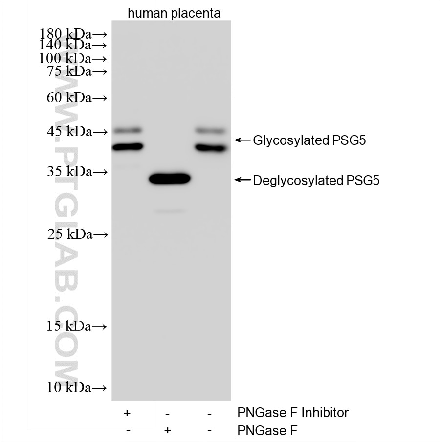 Western Blot (WB) analysis of various lysates using PSG5 Recombinant monoclonal antibody (87956-1-RR)