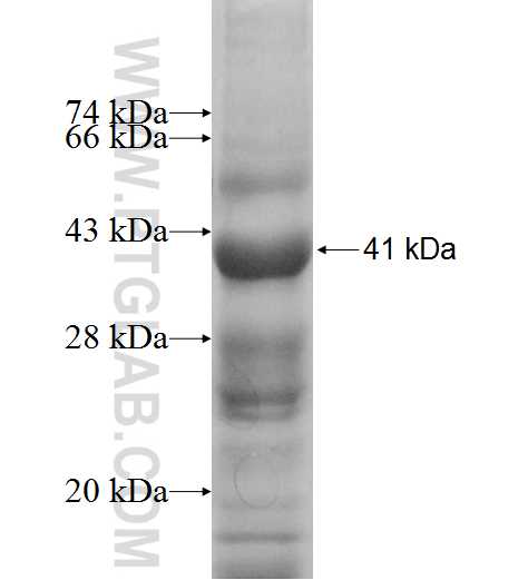 PSG6 fusion protein Ag9660 SDS-PAGE