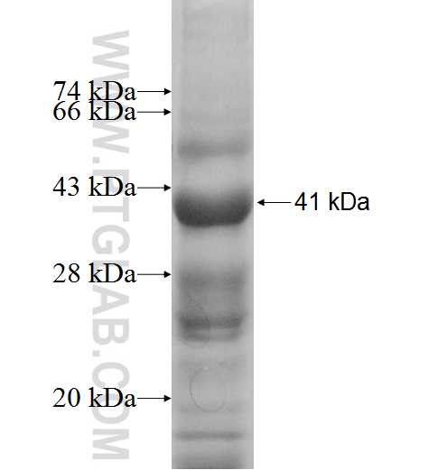 PSG6 fusion protein Ag9660 SDS-PAGE PSG6 fusion protein Ag9660 SDS-PAGE