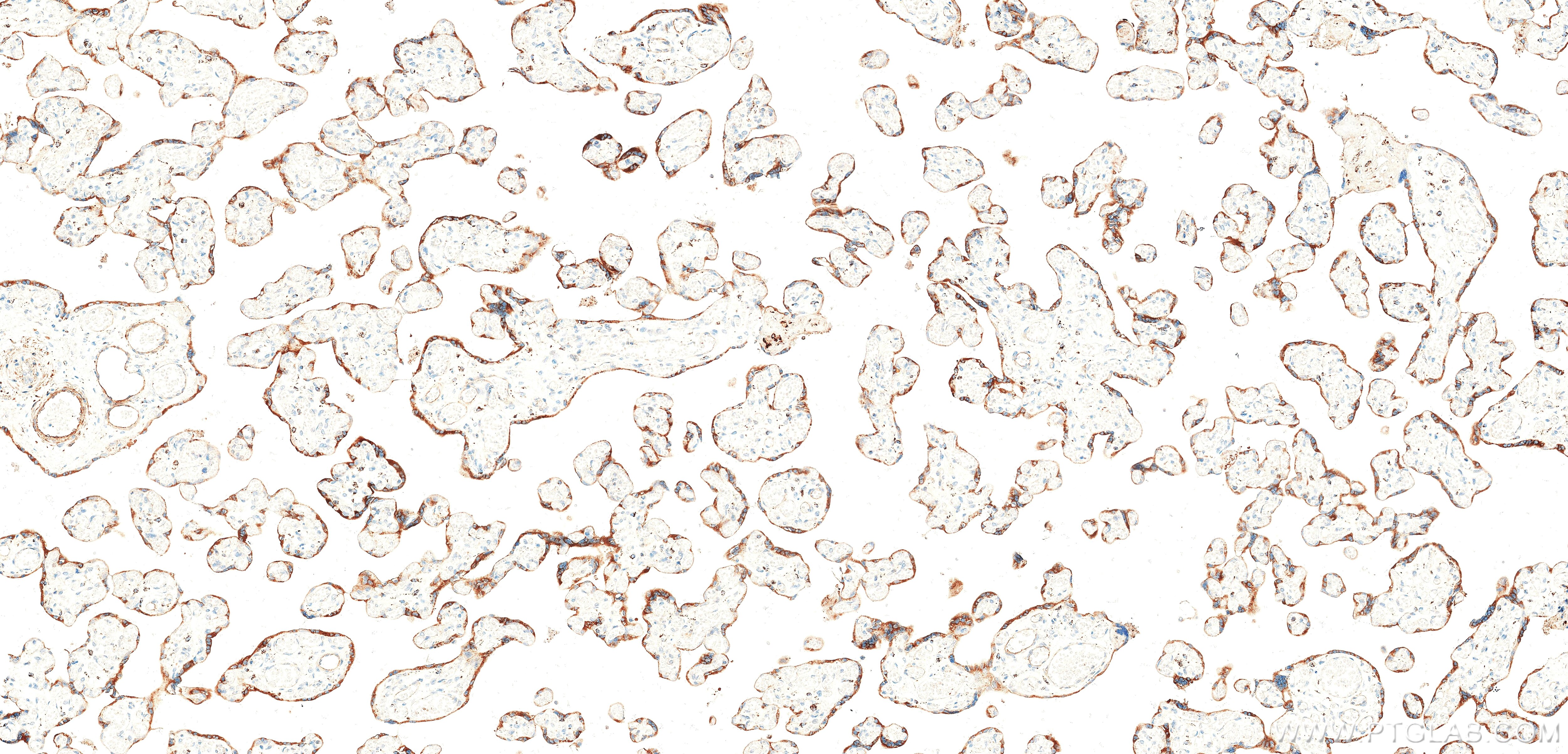 IHC staining of human placenta using 87878-3-RR (same clone as 87878-3-PBS) Immunohistochemistry (IHC) staining of human placenta tissue using PSG8 Recombinant monoclonal antibody (87878-3-RR)