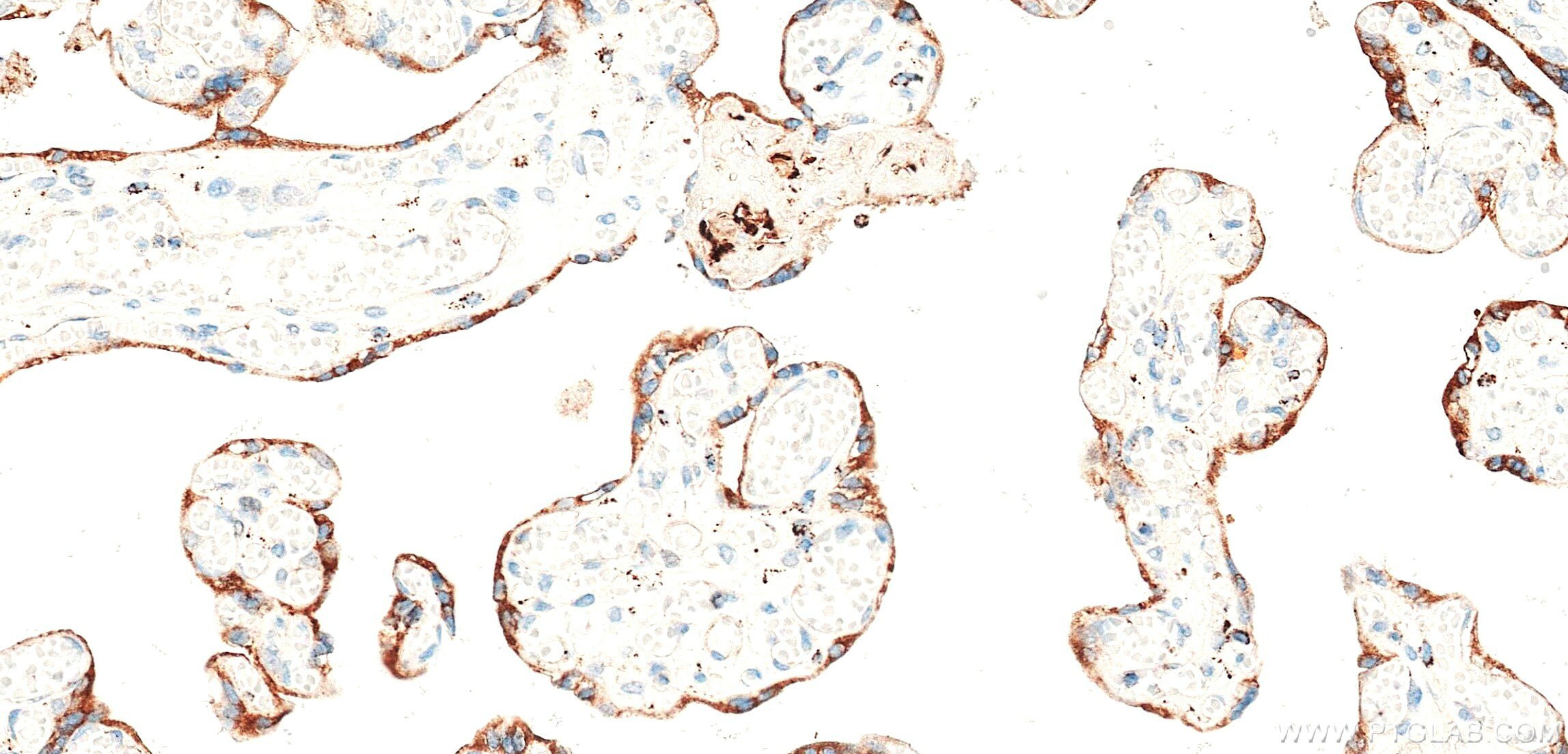 IHC staining of human placenta using 87878-3-RR (same clone as 87878-3-PBS) Immunohistochemistry (IHC) staining of human placenta tissue using PSG8 Recombinant monoclonal antibody (87878-3-RR)