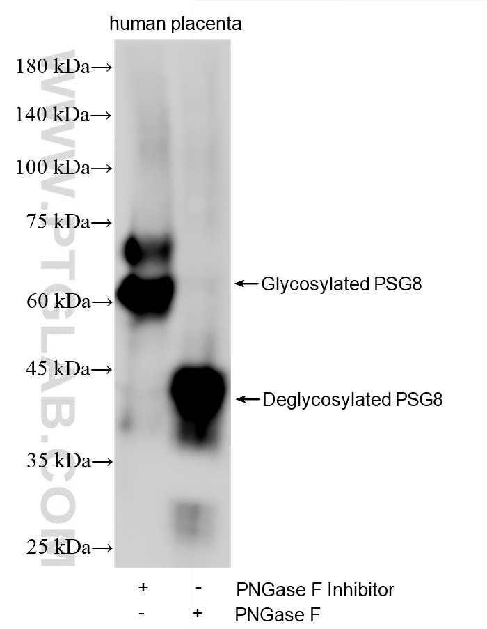 WB analysis using 87878-3-RR (same clone as 87878-3-PBS) Western Blot (WB) analysis of various lysates using PSG8 Recombinant monoclonal antibody (87878-3-RR)