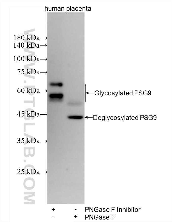 Western Blot (WB) analysis of various lysates using PSG9 Recombinant monoclonal antibody (88037-1-RR)