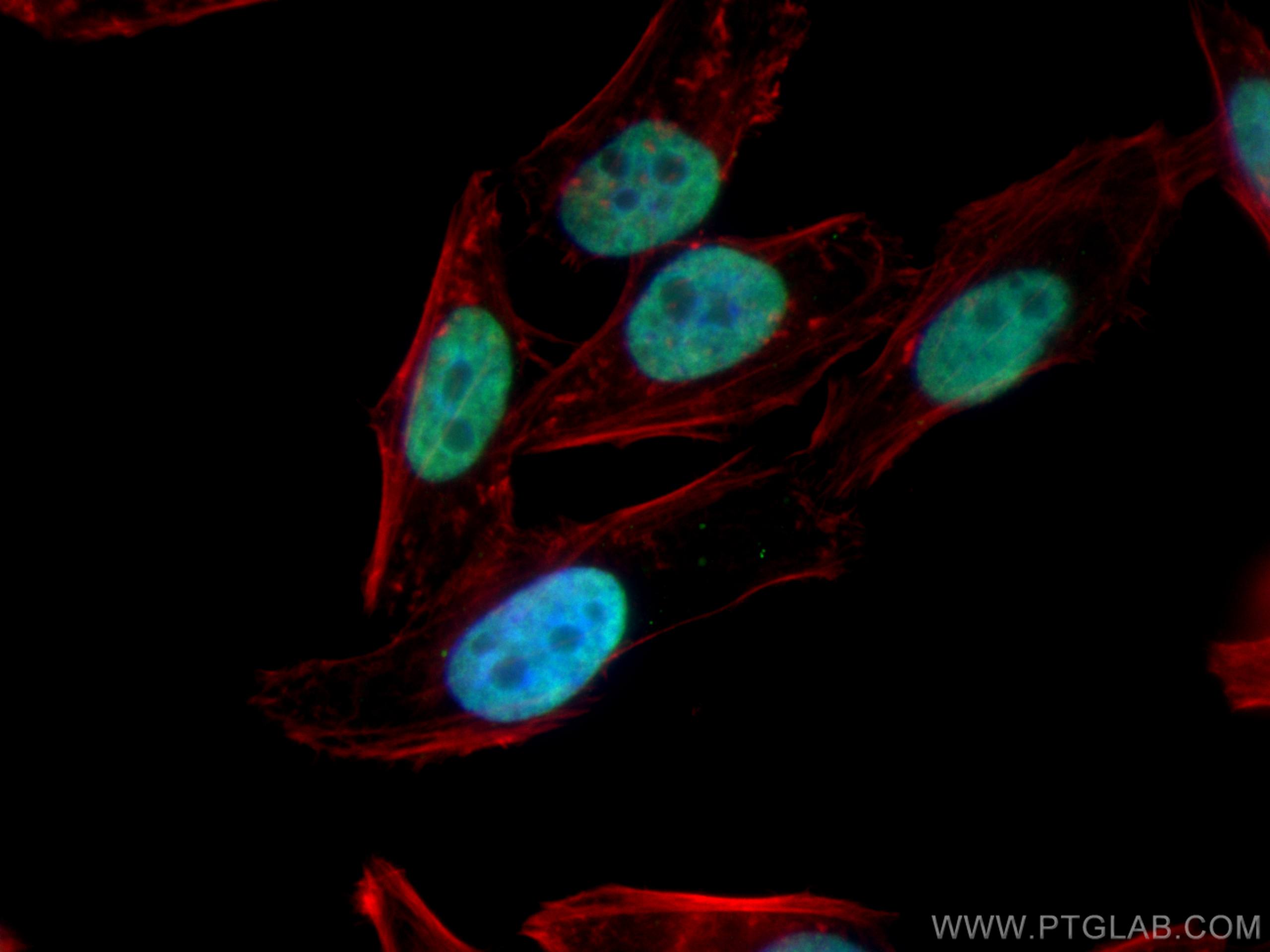 IF Staining of HepG2 using 25504-1-AP