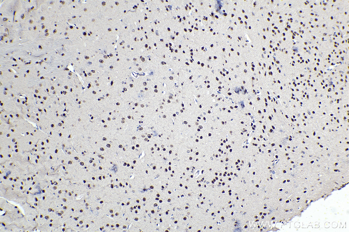 Immunohistochemistry (IHC) staining of mouse brain tissue using PSIP1 Polyclonal antibody (25504-1-AP)