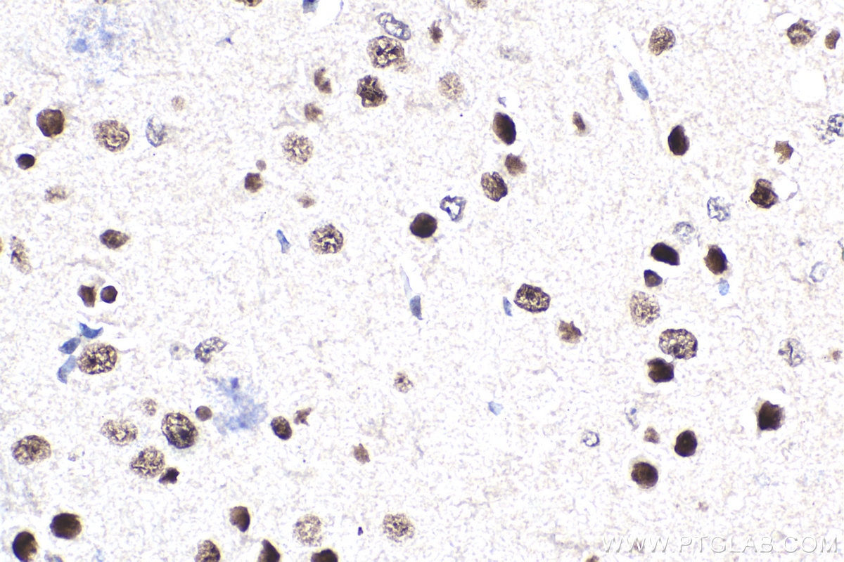 Immunohistochemistry (IHC) staining of mouse brain tissue using PSIP1 Polyclonal antibody (25504-1-AP)