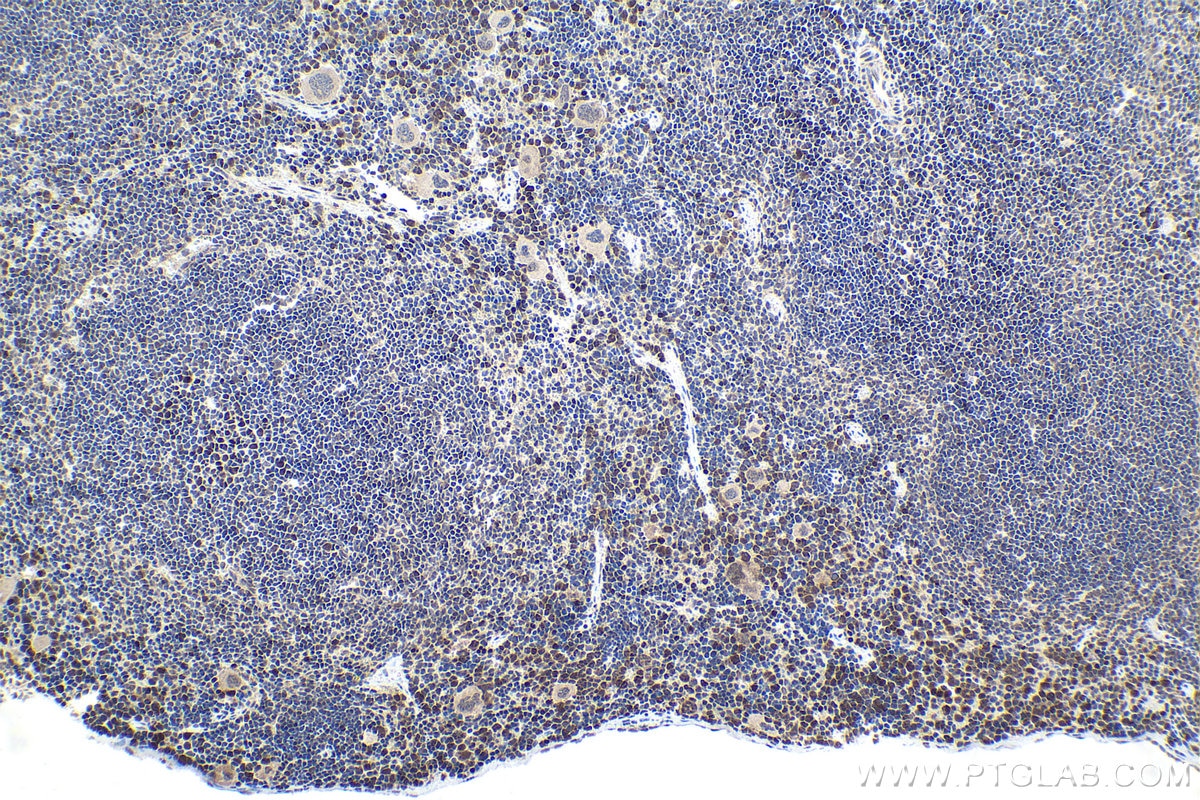 Immunohistochemistry (IHC) staining of mouse spleen tissue using PSIP1 Polyclonal antibody (25504-1-AP)