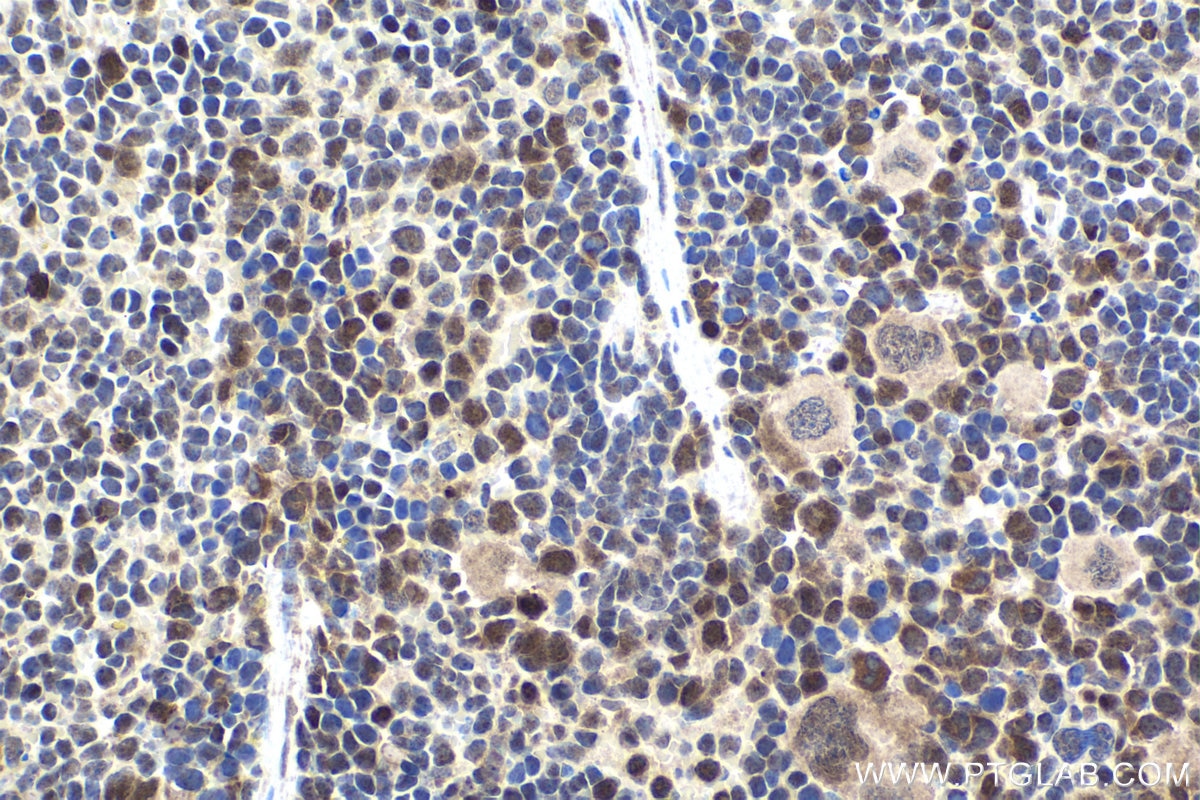 IHC staining of mouse spleen using 25504-1-AP