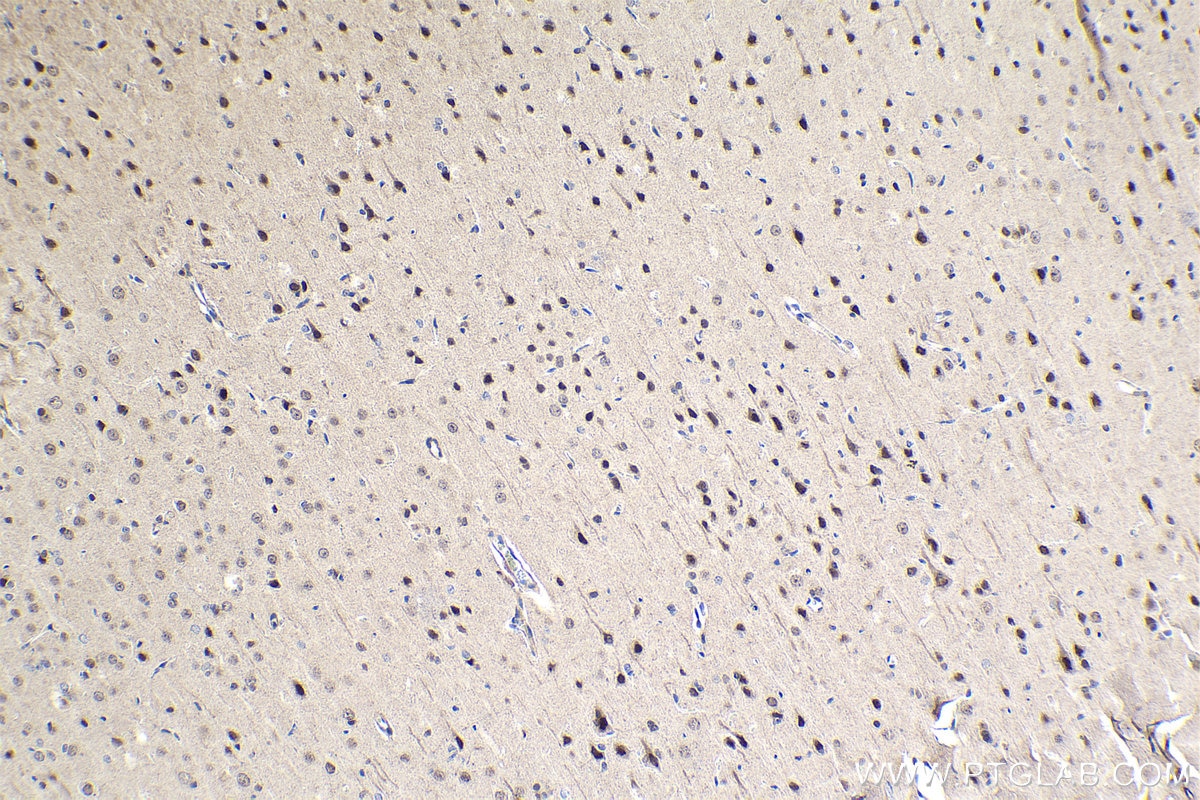 Immunohistochemistry (IHC) staining of rat brain tissue using PSIP1 Polyclonal antibody (25504-1-AP)