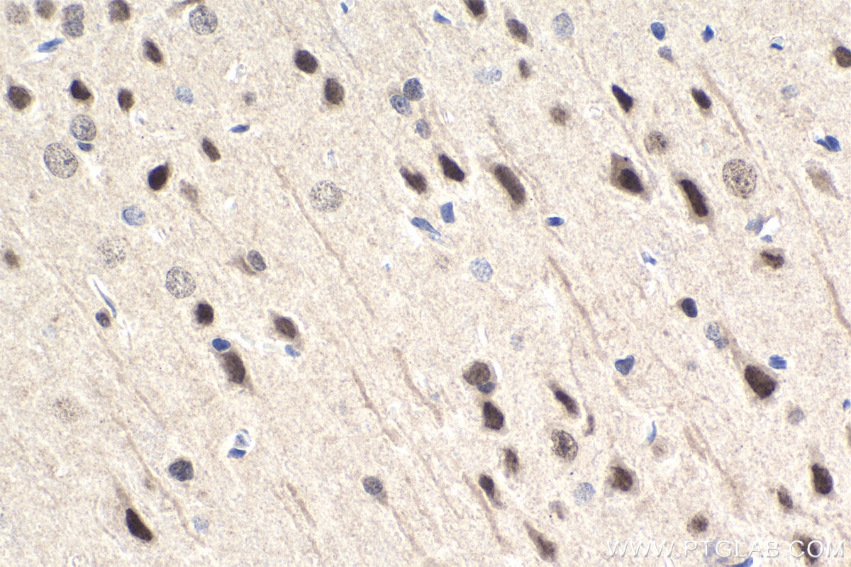 IHC staining of rat brain using 25504-1-AP