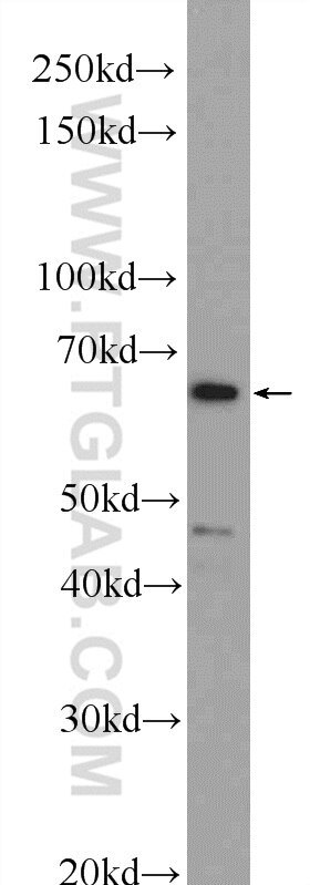 PSIP1 Polyclonal antibody