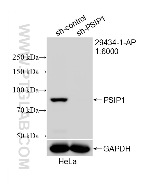 Western Blot (WB) analysis of HeLa cells using PSIP1 Polyclonal antibody (29434-1-AP)