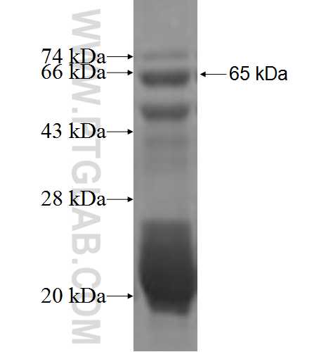 PSKH1 fusion protein Ag5953 SDS-PAGE