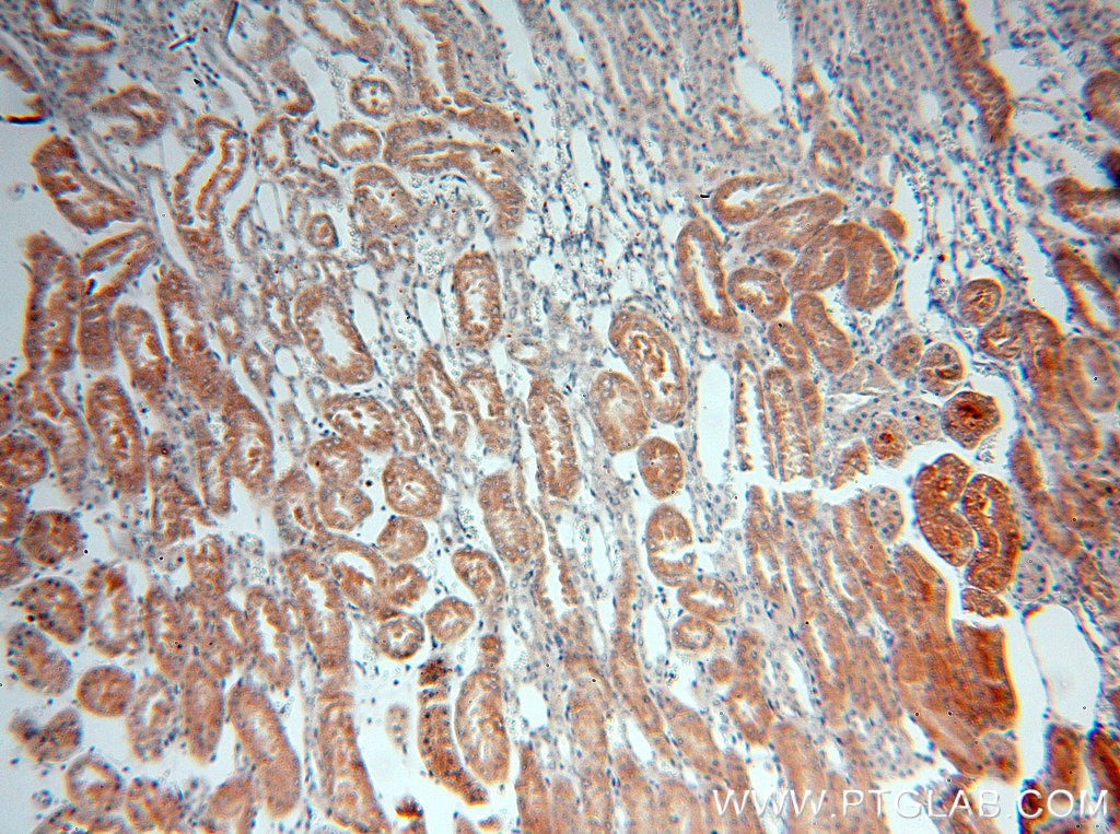 Immunohistochemistry (IHC) staining of human kidney tissue using PSKH2 Polyclonal antibody (18813-1-AP)