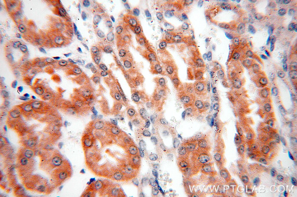 Immunohistochemistry (IHC) staining of human kidney tissue using PSKH2 Polyclonal antibody (18813-1-AP)