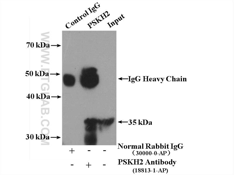 Immunoprecipitation (IP) experiment of HepG2 cells using PSKH2 Polyclonal antibody (18813-1-AP)