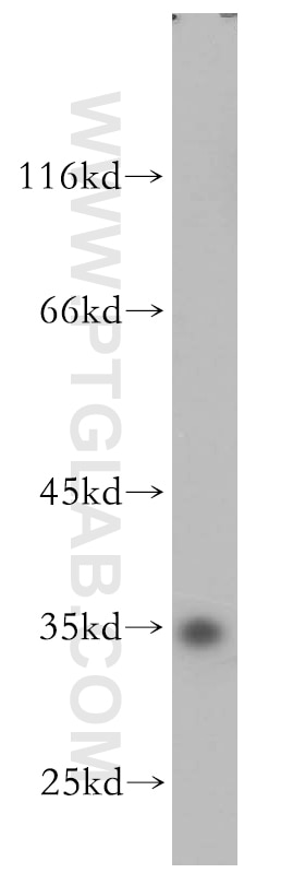 Western Blot (WB) analysis of human brain tissue using PSKH2 Polyclonal antibody (18813-1-AP)