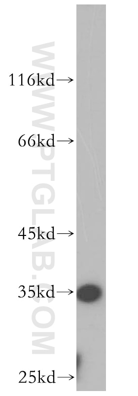 WB analysis of human testis using 18813-1-AP