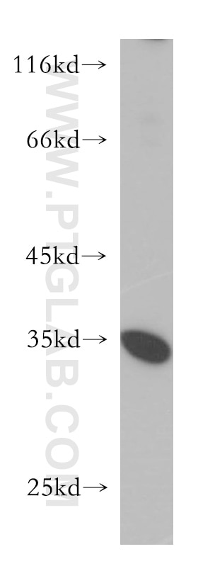 Western Blot (WB) analysis of HepG2 cells using PSKH2 Polyclonal antibody (18813-1-AP)