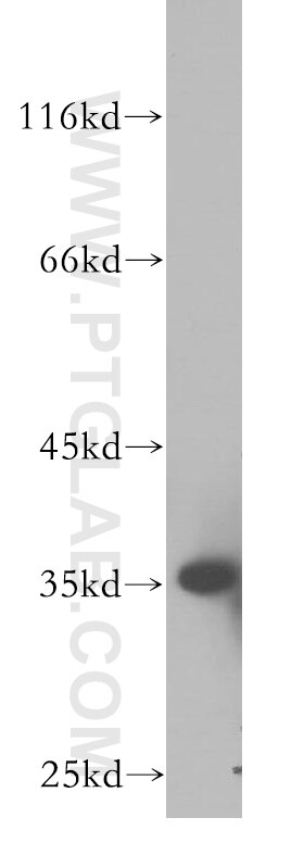 Western Blot (WB) analysis of human heart tissue using PSKH2 Polyclonal antibody (18813-1-AP)