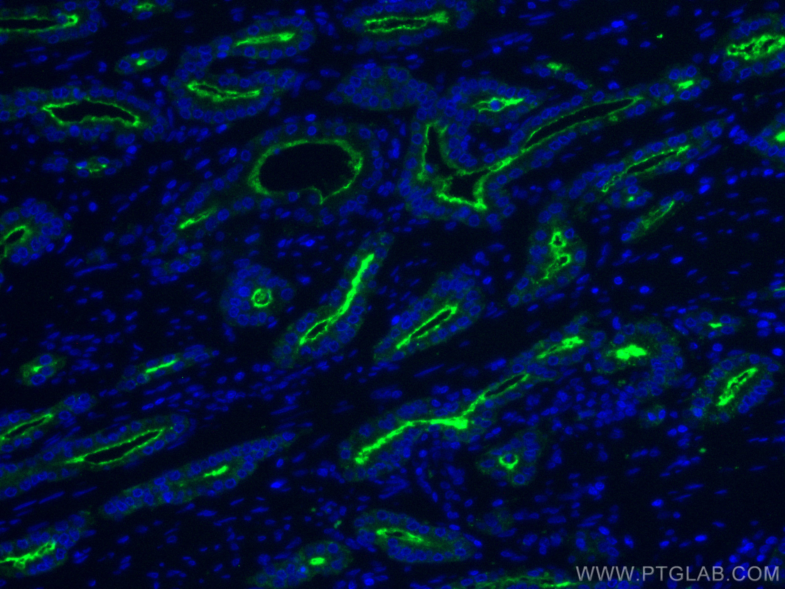 Immunofluorescence (IF) / fluorescent staining of human prostate cancer tissue using CoraLite® Plus 488-conjugated PSMA/GCPII Monoclona (CL488-66678)