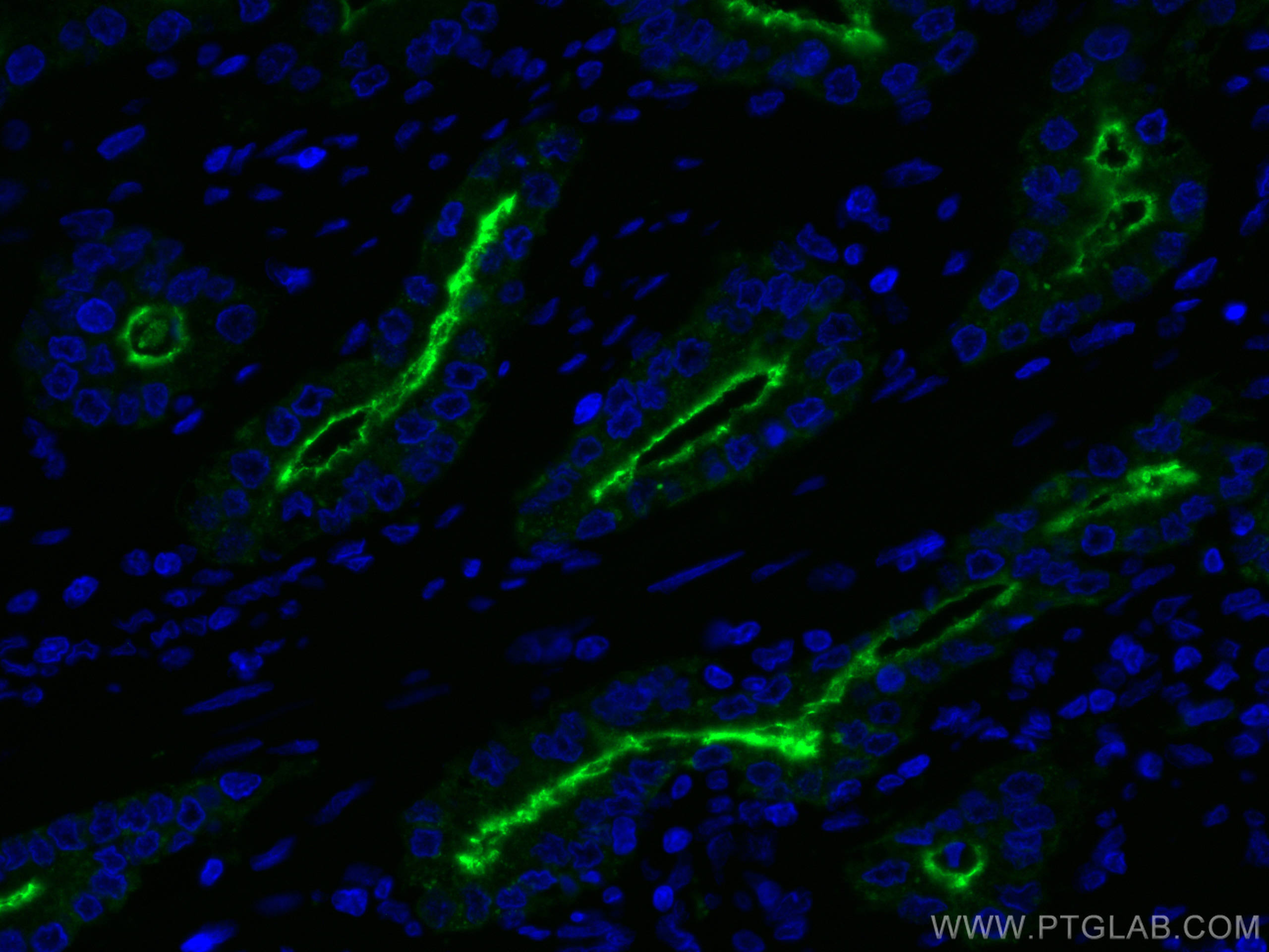 Immunofluorescence (IF) / fluorescent staining of human prostate cancer tissue using CoraLite® Plus 488-conjugated PSMA/GCPII Monoclona (CL488-66678)