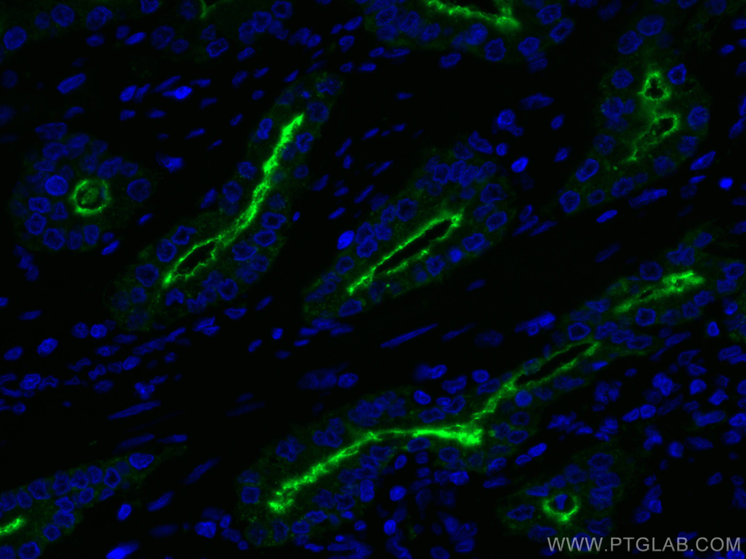 IF Staining of human prostate cancer using CL488-66678