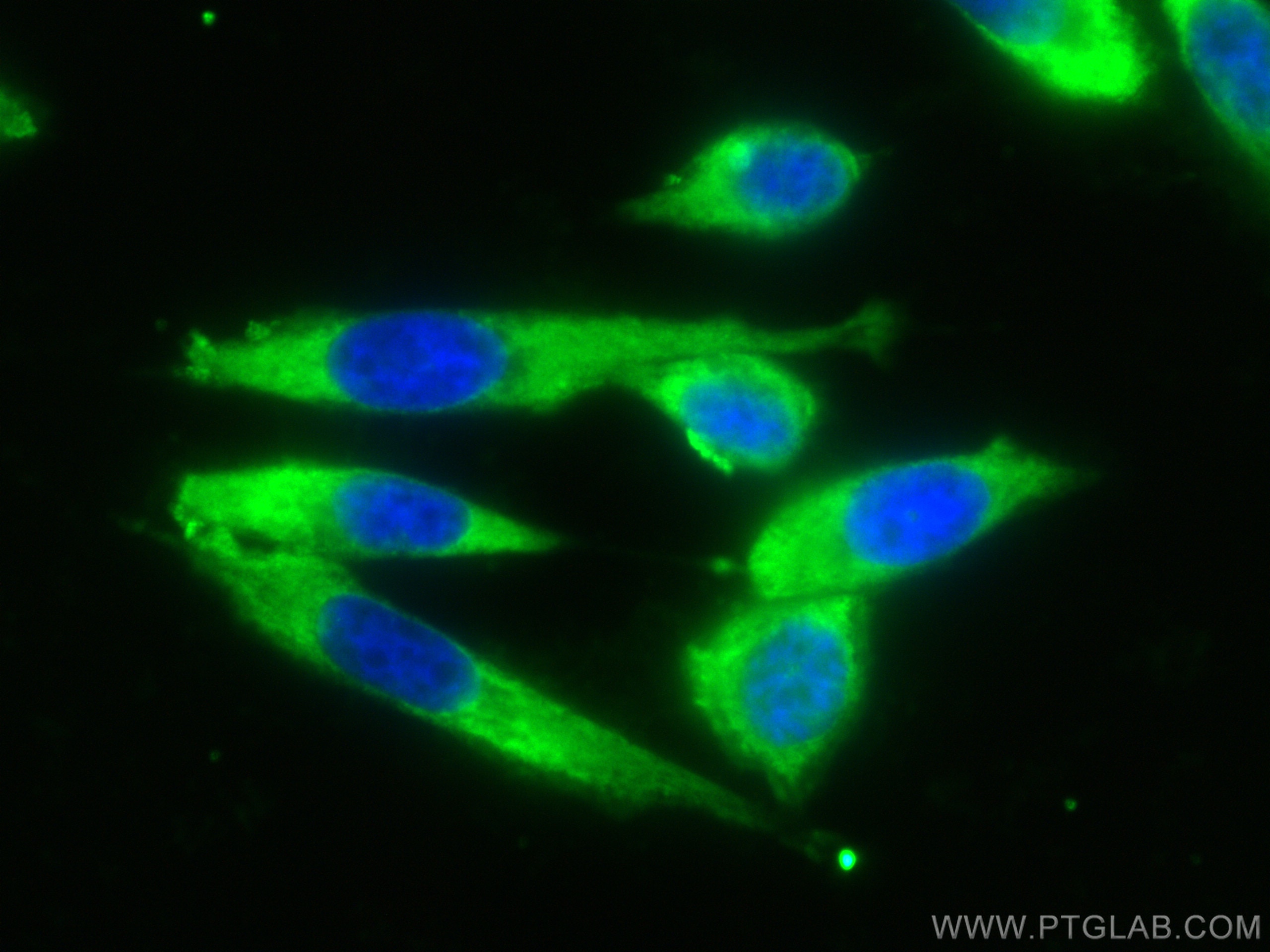 Immunofluorescence (IF) / fluorescent staining of PC-3 cells using CoraLite® Plus 488-conjugated PSMA/GCPII Monoclona (CL488-66678)