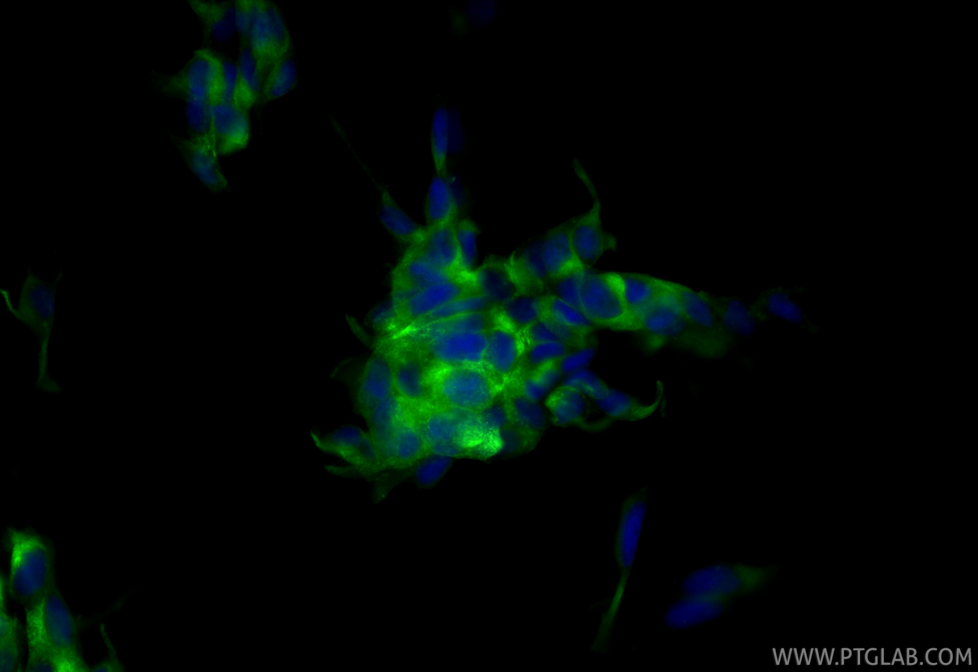 Immunofluorescent analysis of (4% PFA) fixed LNCaP cells using CoraLite® Plus 488 PSMA/GCPII antibody (CL488-84615-2, Clone: 242026F4 ) at dilution of 1:200. Immunofluorescence (IF) / fluorescent staining of LNCaP cells using CoraLite® Plus 488-conjugated PSMA/GCPII Recombina (CL488-84615-2)