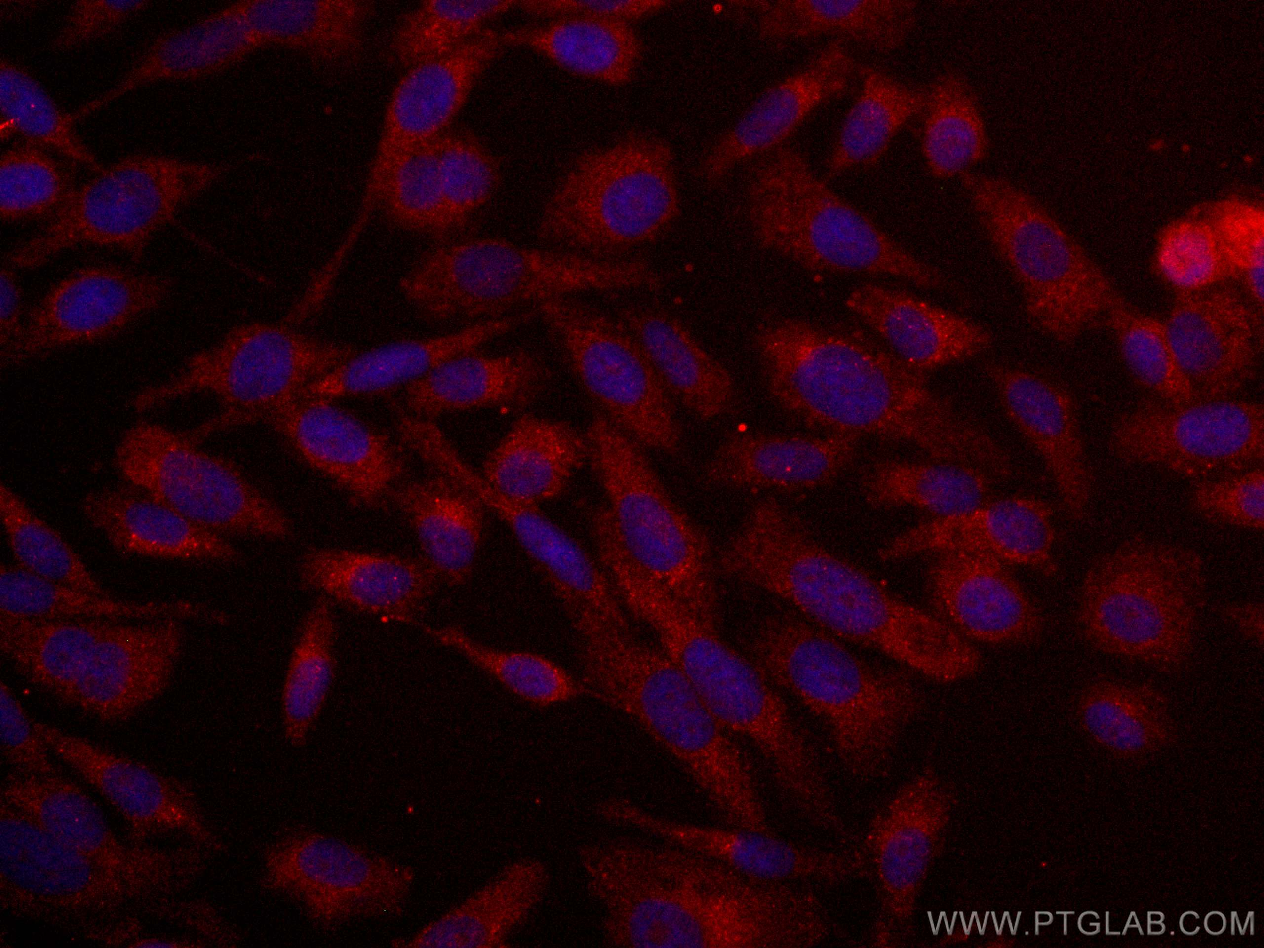 Immunofluorescence (IF) / fluorescent staining of PC-3 cells using CoraLite®594-conjugated PSMA/GCPII Monoclonal anti (CL594-66678)