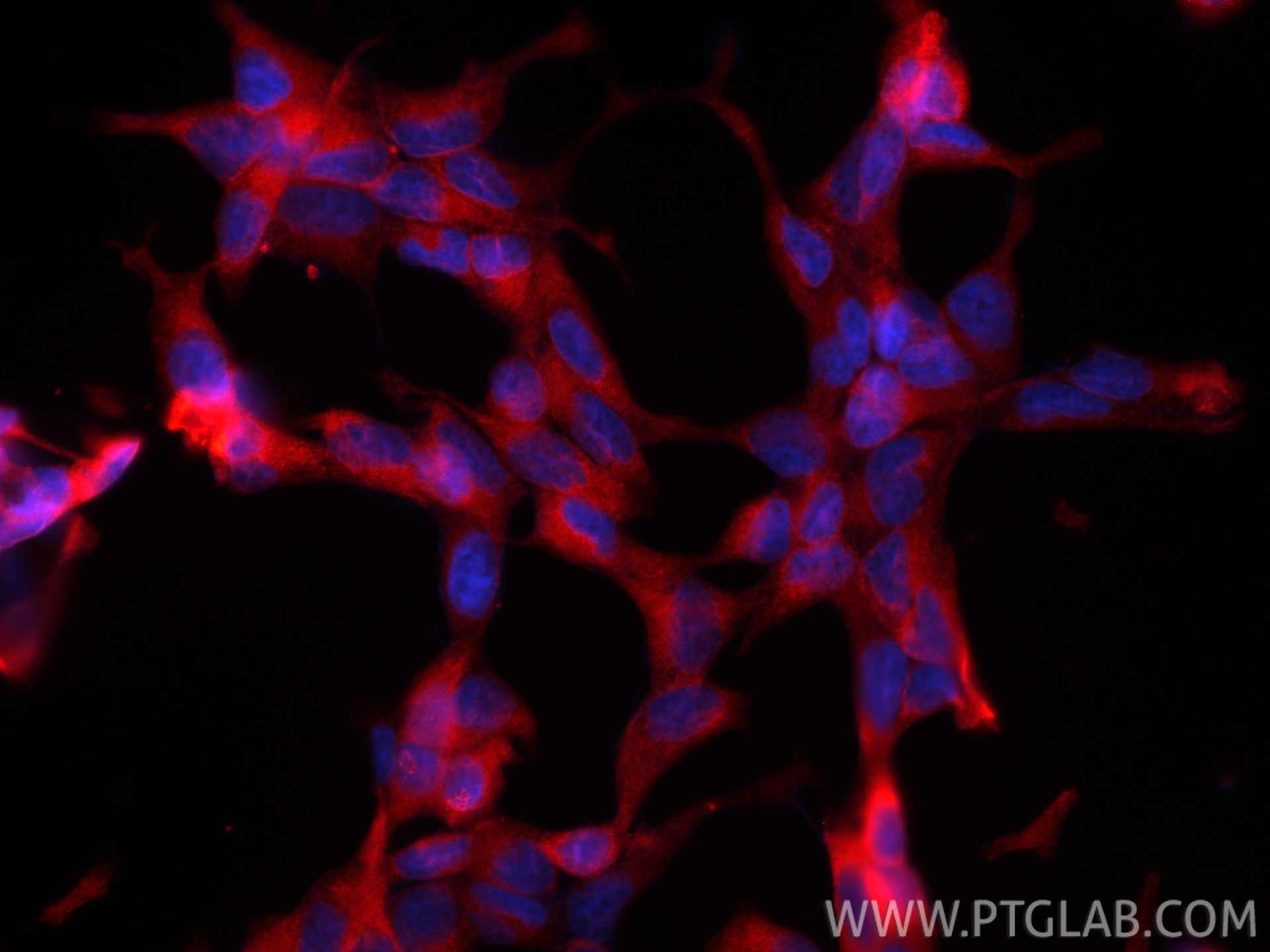 Immunofluorescent analysis of (4% PFA) fixed LNCaP cells using CoraLite®594 PSMA/GCPII antibody (CL594-66678, Clone: 3G4E12 ) at dilution of 1:200. Immunofluorescence (IF) / fluorescent staining of LNCaP cells using CoraLite®594-conjugated PSMA/GCPII Monoclonal anti (CL594-66678)