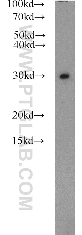 WB analysis of HeLa using 11175-1-AP